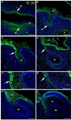 Angled Growth of the Dental Lamina Is Accompanied by Asymmetrical Expression of the WNT Pathway Receptor Frizzled 6